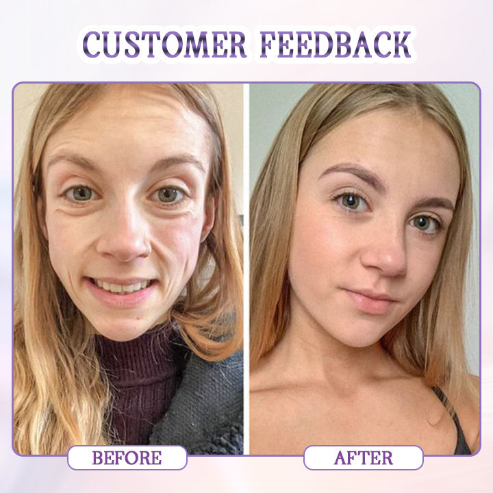 Biancat® Age-Defying Botulinum Facial Serum