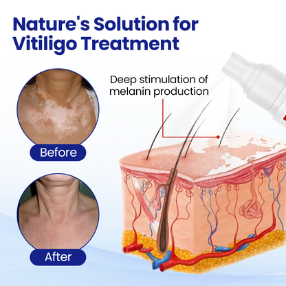 Timilk® VitiClear Herbal Spray -