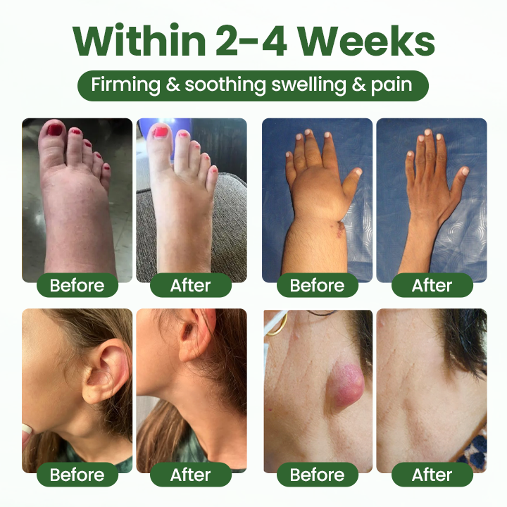 Timilk® BodyRelief Circulation Cream — 48-Hour Visible Swelling Relief