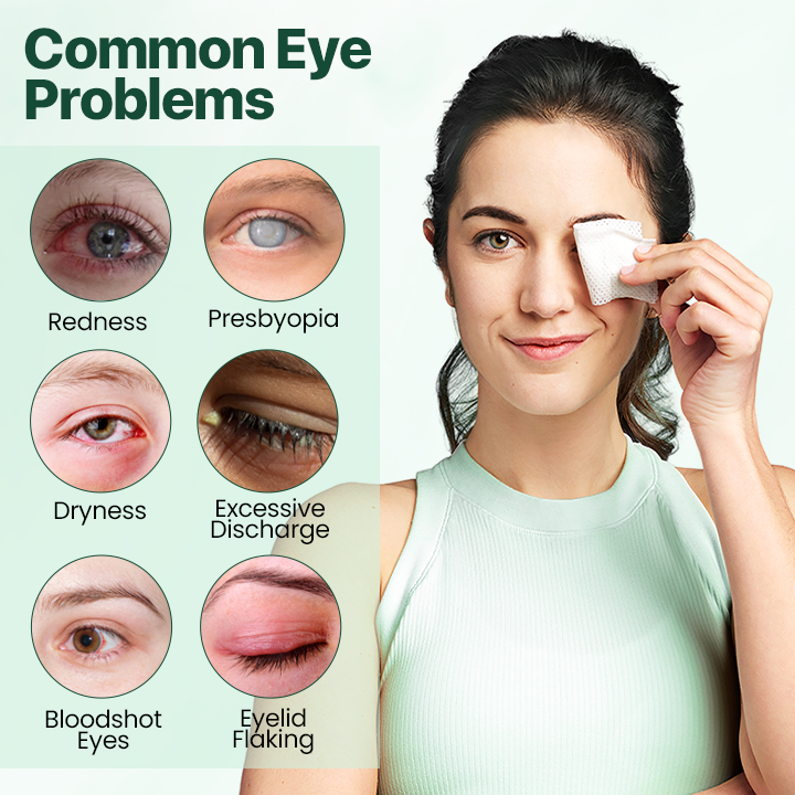 Biancat™ EyeRelief Therapeutic Cleansing Wipes -