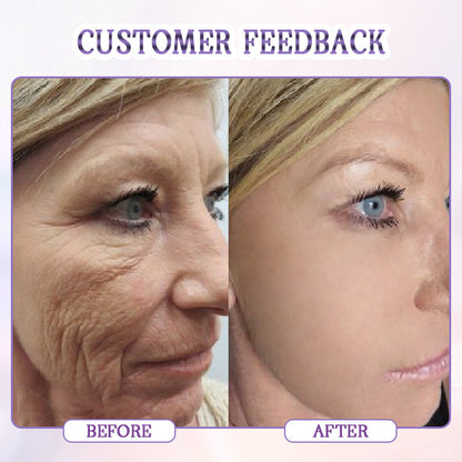 Biancat® Age-Defying Botulinum Facial Serum