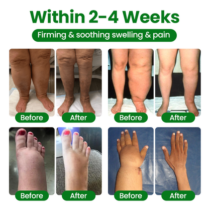 Timilk® VenoLift Leg Relief Spray -