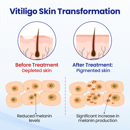 Timilk® VitiClear Herbal Spray -