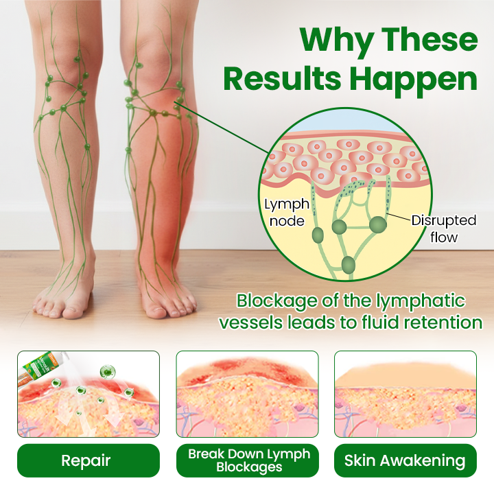 Timilk® VenoLift Leg Relief Spray -