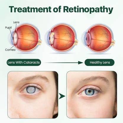 Biancat™ EyeRelief Therapeutic Cleansing Wipes -