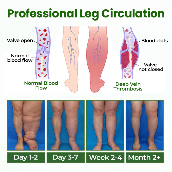 Timilk® BodyRelief Circulation Cream — 48-Hour Visible Swelling Relief