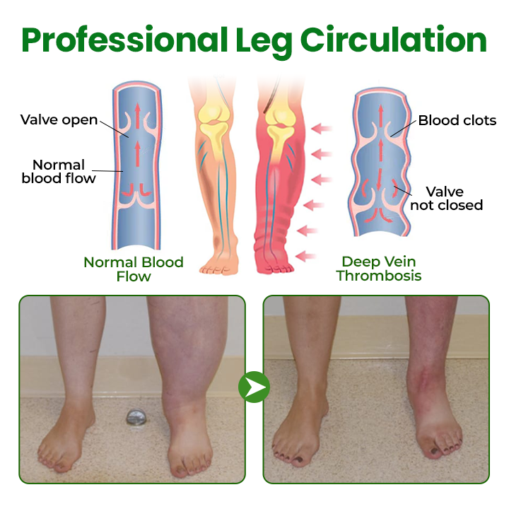 Timilk® VenoLift Leg Relief Spray -