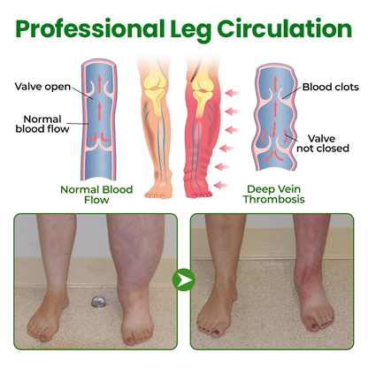 Timilk® VenoLift Leg Relief Spray -